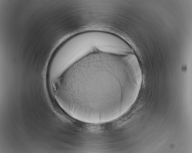 X0000116280438201001111038