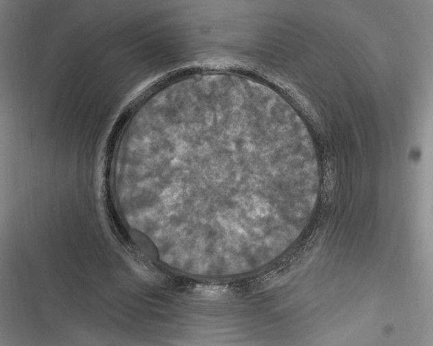 X0000116280440201001111038