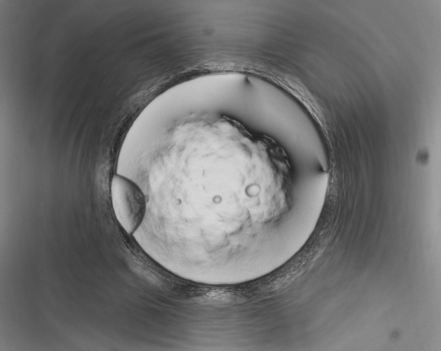 X0000116280441201001111038