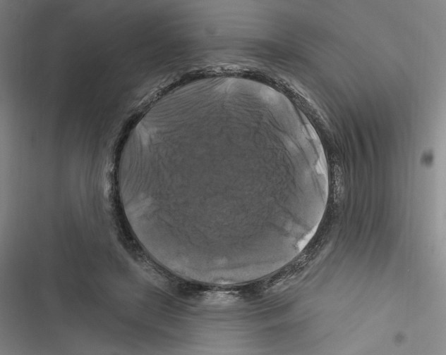 X0000116280451201001111039