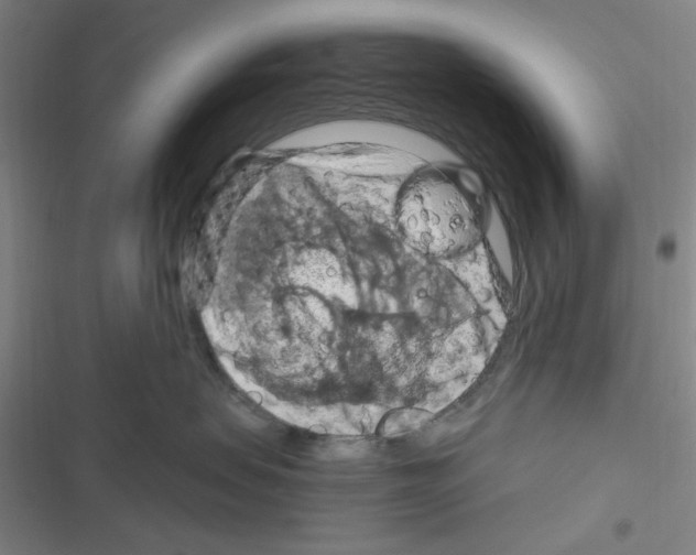 X0000116280479201001111039