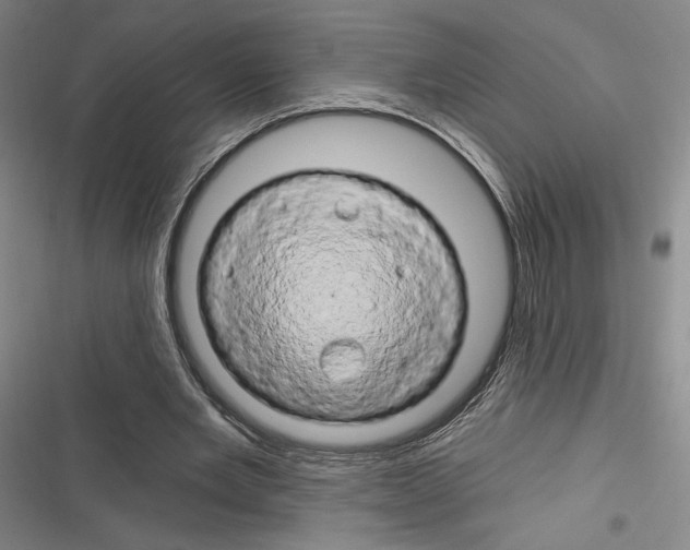 X0000116280485201001111038