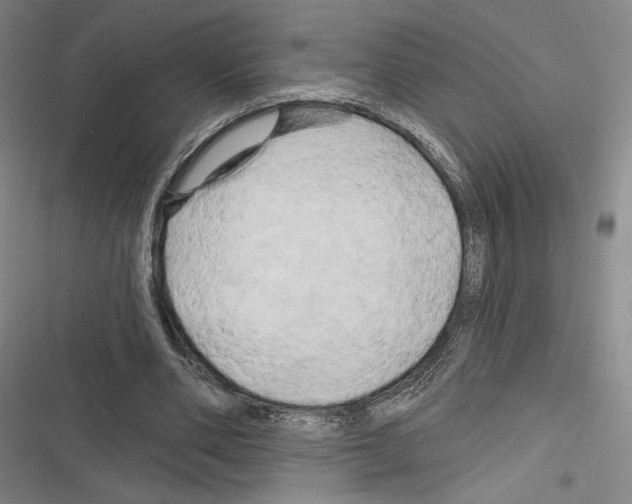 X0000116280486201001111038