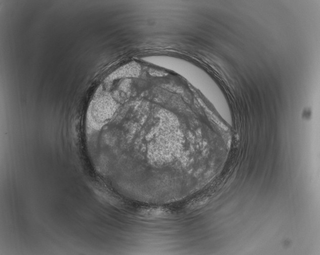 X0000116280503201001111038