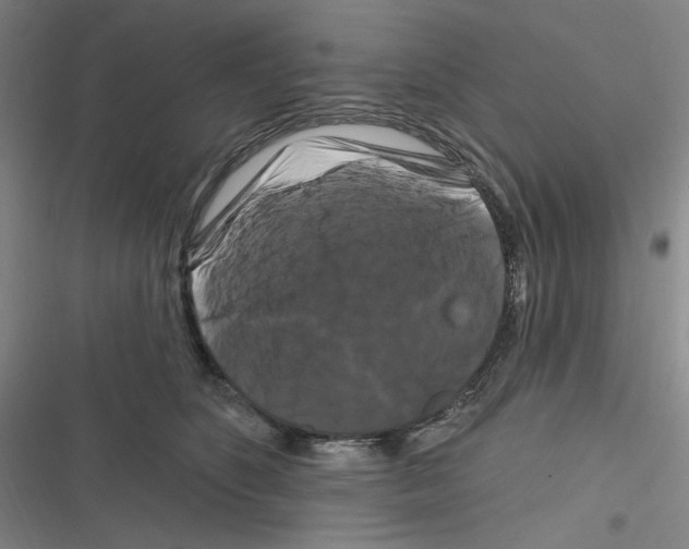 X0000116280516201001111038