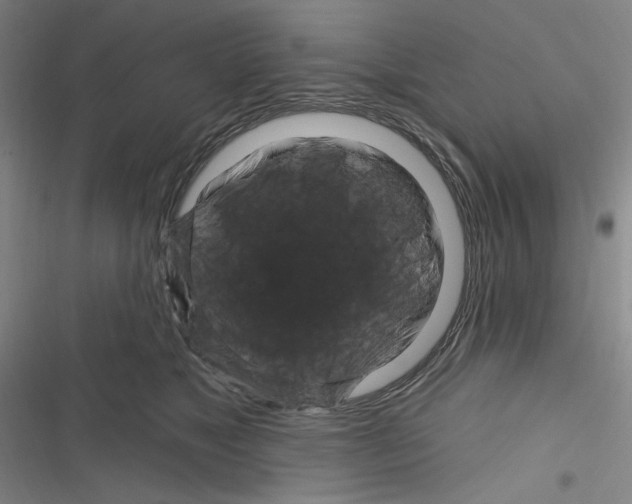 X0000116280517201001111038