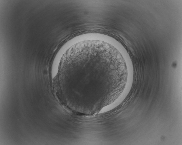 X0000116280524201001111038