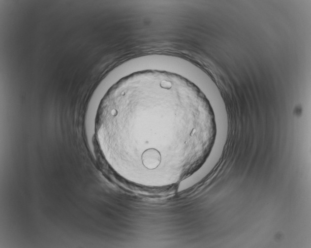 X0000116280525201001111038
