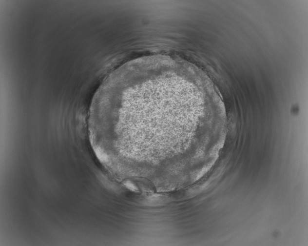 X0000116280527201001111038