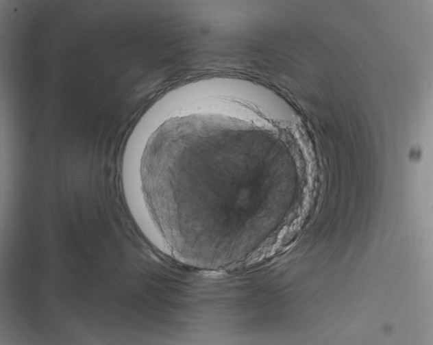 X0000116280528201001111038