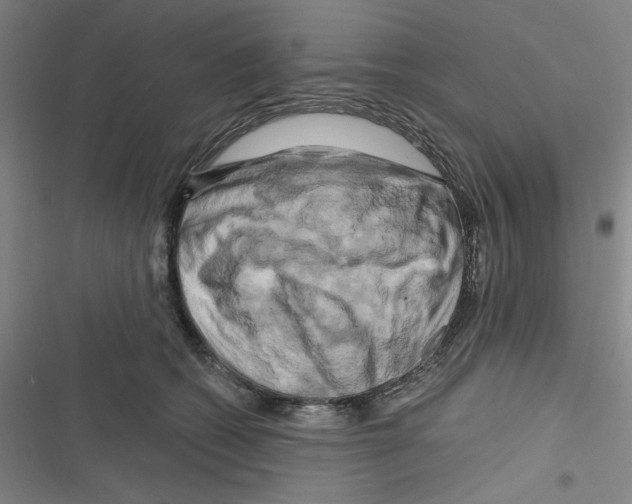 X0000116280562201001111038