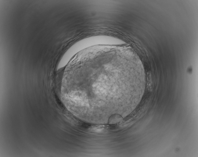 X0000116280563201001111038