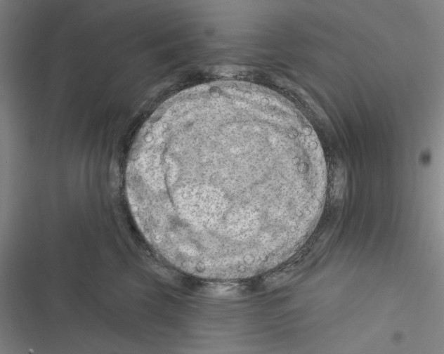 X0000116280569201001111038