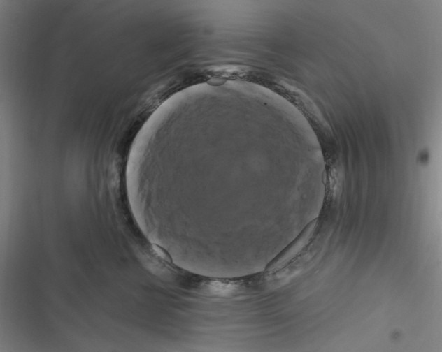 X0000116280570201001111038