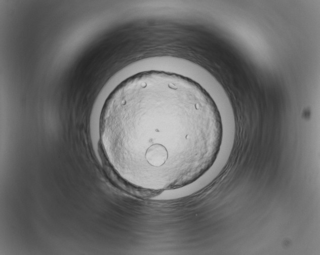 X0000116280574201001111038