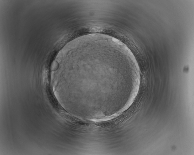 X0000116280598201001111037