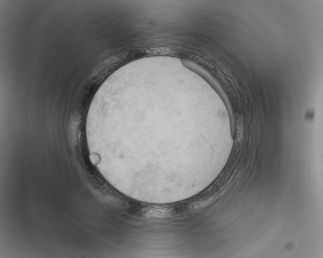 X0000116280599201001111037
