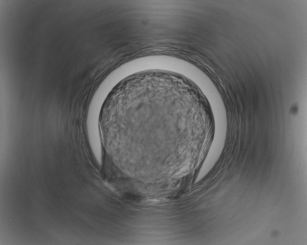 X0000116280617201001111037