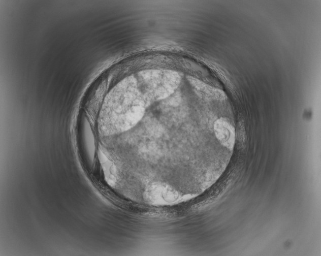 X0000116280630201001111036
