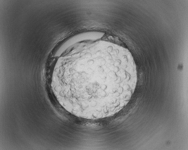 X0000116280638201001111036