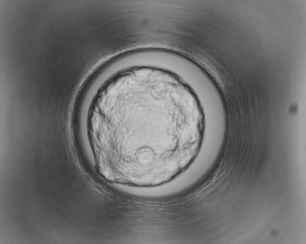 X0000116280676201001111036