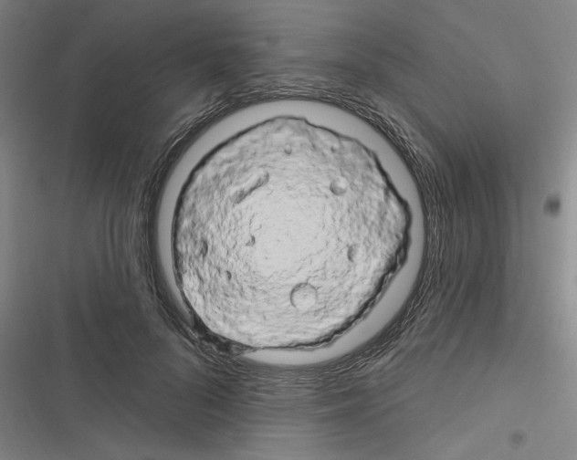 X0000116280696201001111035