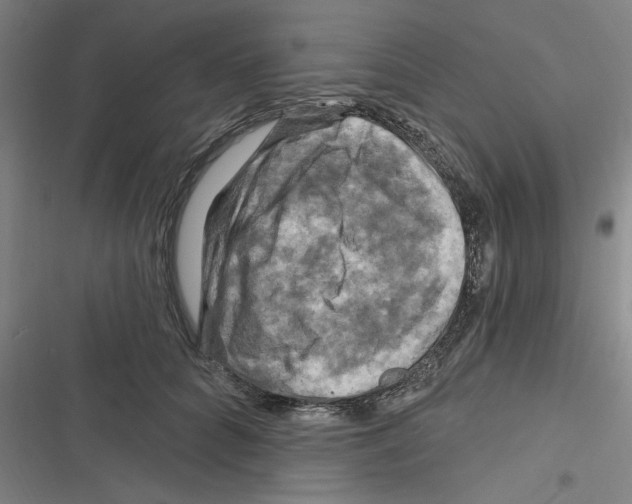 X0000116280704201001111035