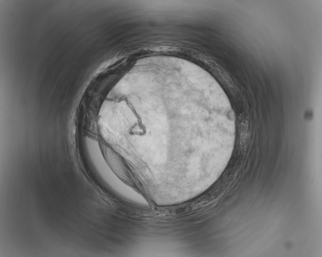 X0000116280727201001111035