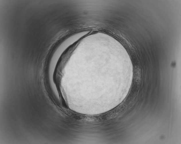 X0000116280738201001111035