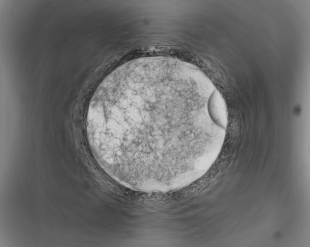 X0000116280817201001111033
