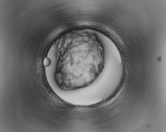 X0000116280825201001111033
