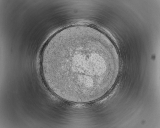 X0000116280835201001111033