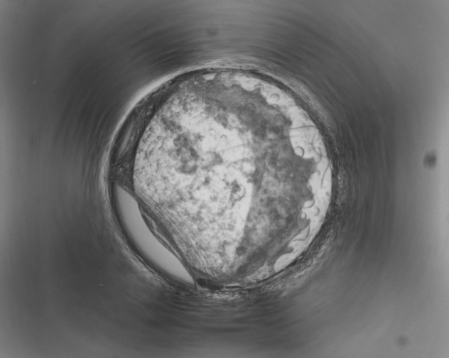 X0000116280838201001111033