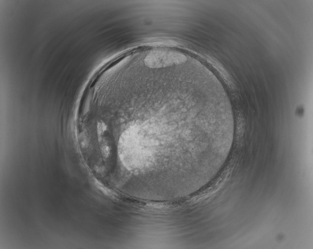 X0000116280840201001111033