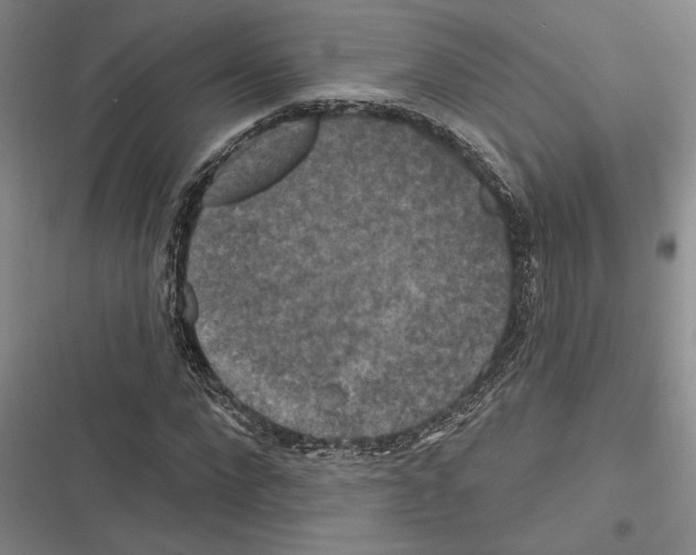 X0000116280872201001111033