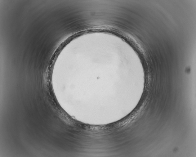 X0000116280875201001111033