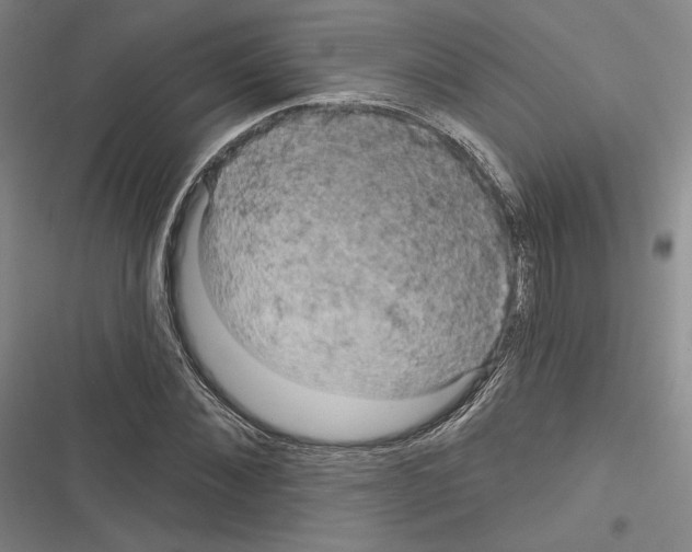 X0000116280876201001111033