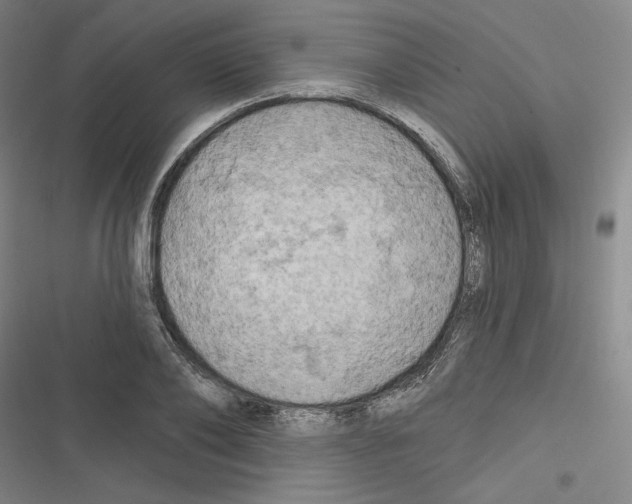 X0000116280886201001111033
