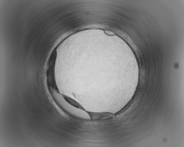 X0000116280898201001111033