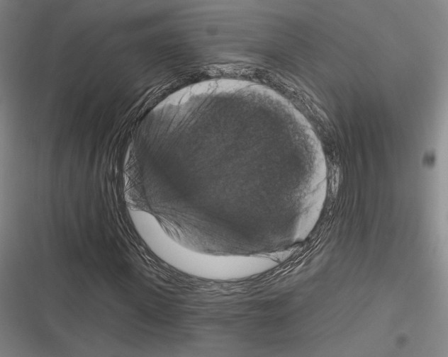 X0000116280915201001111032
