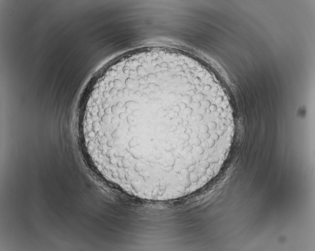 X0000116280931201001111032