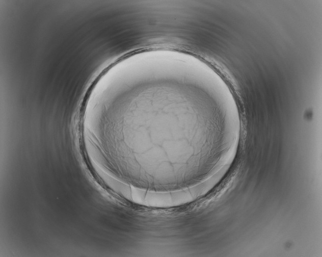 X0000116280941201001111032
