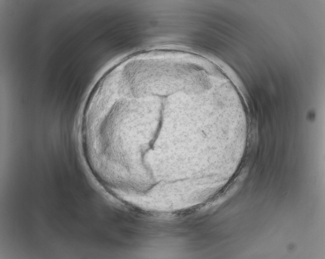 X0000116280957201001111032