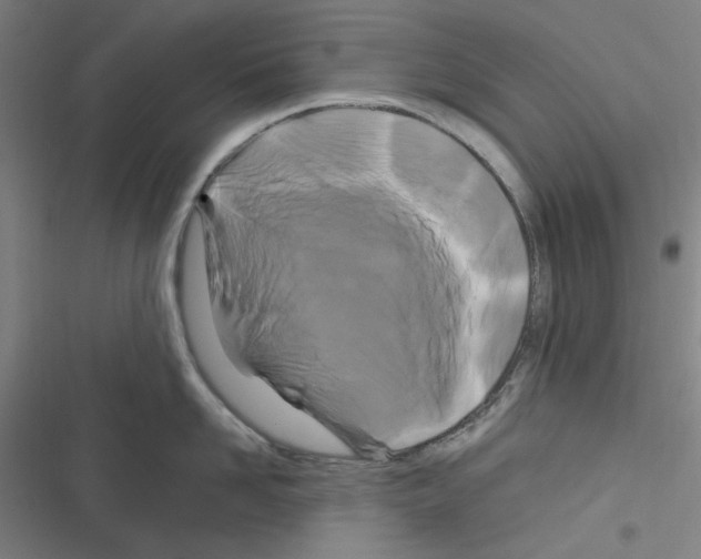 X0000116280958201001111032