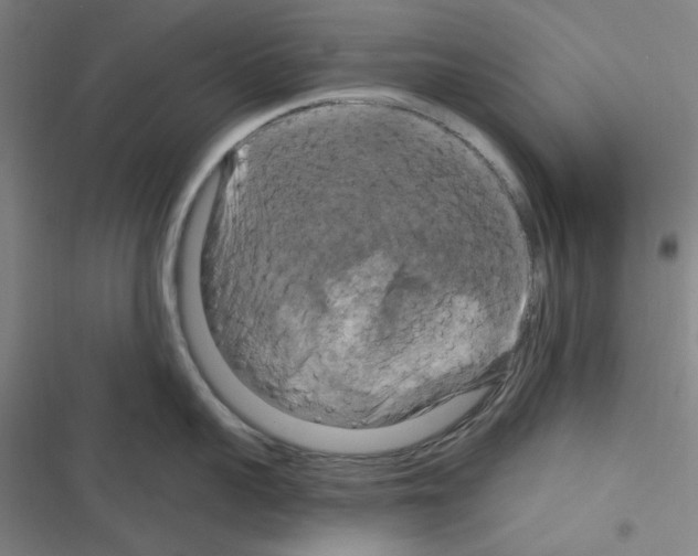 X0000116280959201001111032