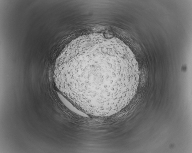 X0000116280962201001111032