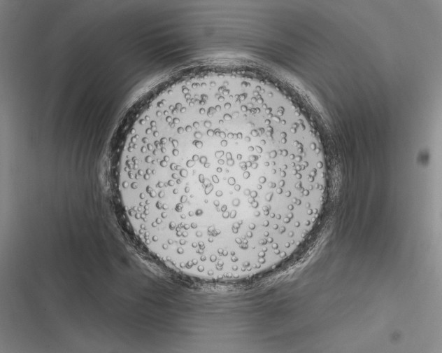 X0000116280970201001111032