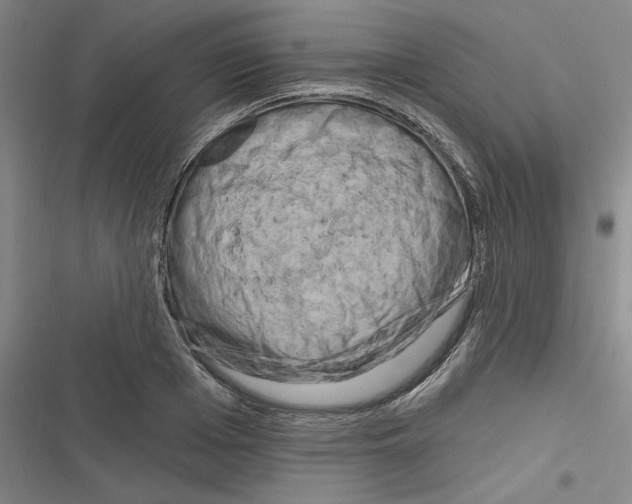 X0000116280985201001111032