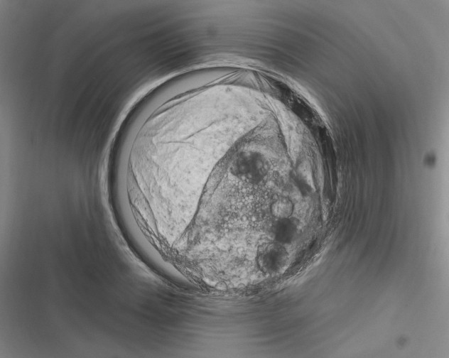 X0000116280987201001111031