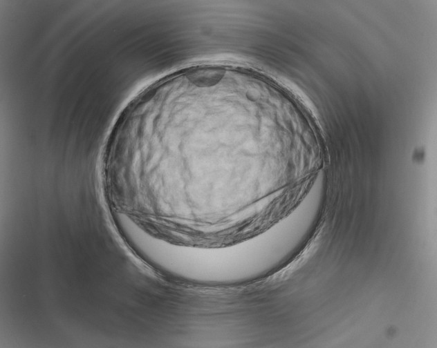 X0000116280989201001111031